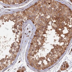 G5pr Antibody, Novus Biologicals 25 &mu;L; Unlabeled:Antibodies, Polyclonal
