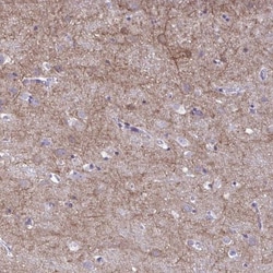 GABA-AR alpha 1 Antibody, Novus Biologicals 0.1mL; Unlabeled:Antibodies,