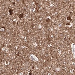 GABA-AR alpha 3 Antibody, Novus Biologicals 0.1mL; Unlabeled:Antibodies,