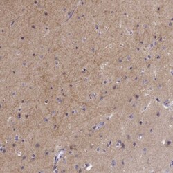 GABA-AR alpha 3 Antibody, Novus Biologicals 0.1mL; Unlabeled:Antibodies,