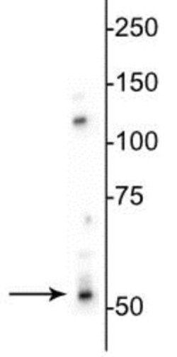 GABA-A R beta 3 Antibody, Novus Biologicals 0.02mL:Antibodies, Polyclonal