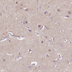 GABA-A R delta Antibody, Novus Biologicals:Antibodies:Primary Antibodies