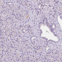 GABA-A R delta Antibody, Novus Biologicals:Antibodies:Primary Antibodies