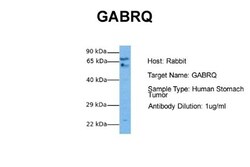 GABA-A R theta Antibody, Novus Biologicals 0.05mg; Unlabeled:Antibodies,