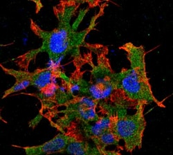 GABA-B R1 Antibody (S93A-49), Novus Biologicals:Antibodies:Primary Antibodies