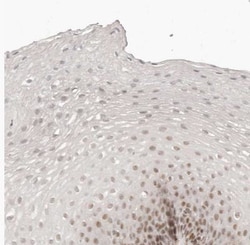 GABPA Antibody, Novus Biologicals 0.1mL; Unlabeled:Antibodies, Polyclonal