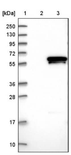 GABPA Antibody, Novus Biologicals 0.1mL; Unlabeled:Antibodies, Polyclonal