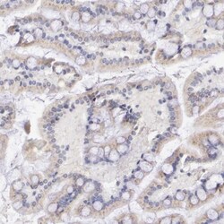 GAL3ST1 Antibody, Novus Biologicals 25 &mu;L; Unlabeled:Antibodies, Polyclonal