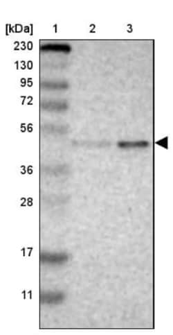 GALK1 Antibody, Novus Biologicals 0.1mL; Unlabeled:Antibodies, Polyclonal