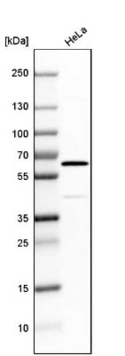 GALNT2 Antibody, Novus Biologicals 25 &mu;L | Buy Online | Novus Biologicals | Fisher Scientific