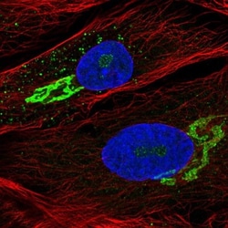 GALNT5 Antibody, Novus Biologicals 0.1mL; Unlabeled:Antibodies, Polyclonal