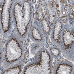 GALNT6 Antibody, Novus Biologicals 25 &mu;L; Unlabeled:Antibodies, Polyclonal