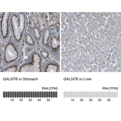 GALNT6 Antibody, Novus Biologicals 25 &mu;L; Unlabeled:Antibodies, Polyclonal