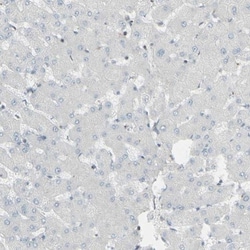GALNT6 Antibody, Novus Biologicals:Antibodies:Primary Antibodies