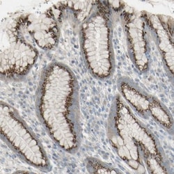 GALNT6 Antibody, Novus Biologicals:Antibodies:Primary Antibodies