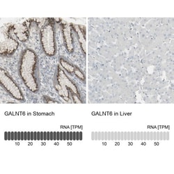 GALNT6 Antibody, Novus Biologicals:Antibodies:Primary Antibodies