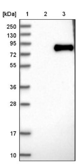 GALNT6 Antibody, Novus Biologicals 25 &mu;L; Unlabeled:Antibodies, Polyclonal