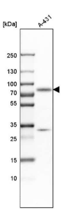 GALNT6 Antibody, Novus Biologicals:Antibodies:Primary Antibodies