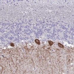 GALNTL1 Antibody, Novus Biologicals 25 &mu;L, Unlabeled:Antibodies, Polyclonal