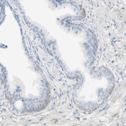 GALNTL5 Antibody, Novus Biologicals 0.1mL; Unlabeled:Antibodies, Polyclonal