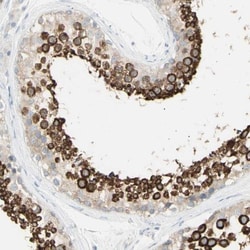 GALNTL5 Antibody, Novus Biologicals 0.1mL; Unlabeled:Antibodies, Polyclonal