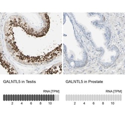 GALNTL5 Antibody, Novus Biologicals 0.1mL; Unlabeled:Antibodies, Polyclonal