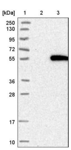 GALNTL5 Antibody, Novus Biologicals 0.1mL; Unlabeled:Antibodies, Polyclonal