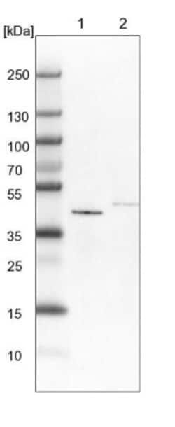 GALT Antibody, Novus Biologicals:Antibodies:Primary Antibodies