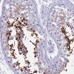 GAPDH-2 Antibody, Novus Biologicals 25 &mu;L, Unlabeled:Antibodies, Polyclonal