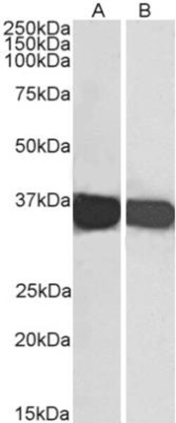 GAPDH Antibody, Novus Biologicals 0.1mg; Unlabeled:Antibodies, Polyclonal