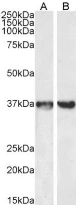 GAPDH Antibody, Novus Biologicals 0.1mg; Unlabeled:Antibodies, Polyclonal