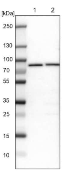 GARS Antibody, Novus Biologicals 0.1mL; Unlabeled:Antibodies, Polyclonal