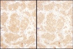 GART Antibody, Novus Biologicals 0.1mg; Unlabeled:Antibodies, Polyclonal