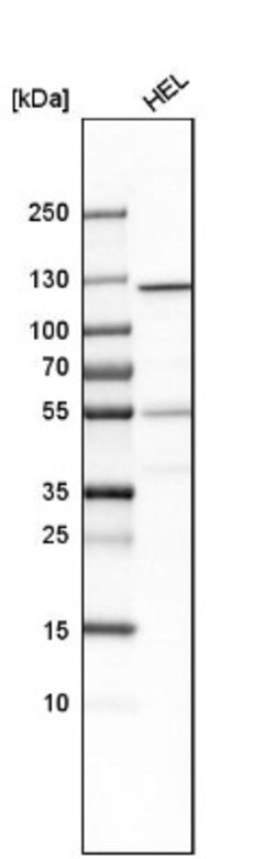 GART Antibody, Novus Biologicals 25 &mu;L | Buy Online | Novus Biologicals | Fisher Scientific
