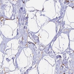 GAS8 Antibody, Novus Biologicals 0.1mL; Unlabeled:Antibodies, Polyclonal
