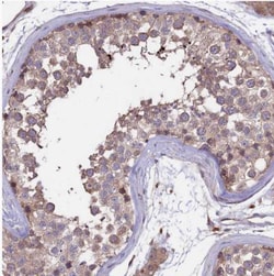 GAS8 Antibody, Novus Biologicals 0.1mL; Unlabeled:Antibodies, Polyclonal