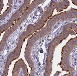 GAS8 Antibody, Novus Biologicals 0.1mL; Unlabeled:Antibodies, Polyclonal