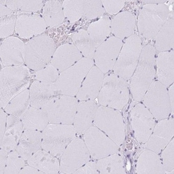 GAT-1/SLC6A1 Antibody, Novus Biologicals:Antibodies:Primary Antibodies
