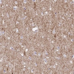 GAT-1/SLC6A1 Antibody, Novus Biologicals:Antibodies:Primary Antibodies