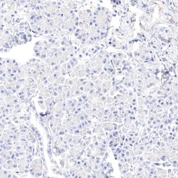 GATA-1 Antibody, Novus Biologicals 0.1mL; Unlabeled:Antibodies, Polyclonal