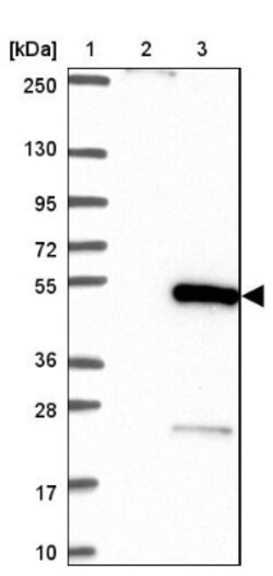 GATA-1 Antibody, Novus Biologicals 0.1mL; Unlabeled:Antibodies, Polyclonal