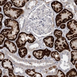 GATM Antibody, Novus Biologicals 25 &mu;L; Unlabeled:Antibodies, Polyclonal