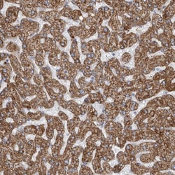 GATM Antibody, Novus Biologicals 25 &mu;L; Unlabeled:Antibodies, Polyclonal