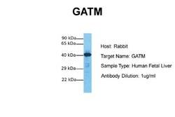 GATM Antibody, Novus Biologicals:Antibodies:Primary Antibodies