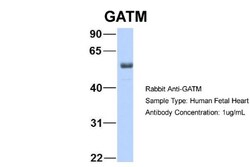 GATM Antibody, Novus Biologicals:Antibodies:Primary Antibodies