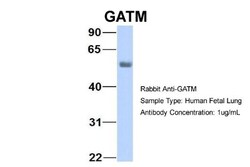 GATM Antibody, Novus Biologicals:Antibodies:Primary Antibodies