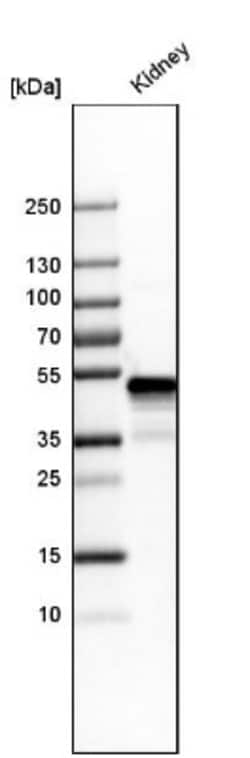 GATM Antibody, Novus Biologicals 25 &mu;L; Unlabeled:Antibodies, Polyclonal