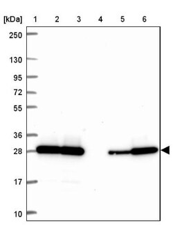 GBAS Antibody, Novus Biologicals:Antibodies:Primary Antibodies