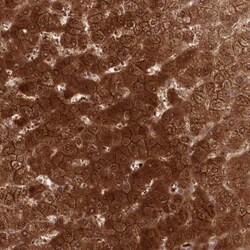 GBE1 Antibody, Novus Biologicals:Antibodies:Primary Antibodies