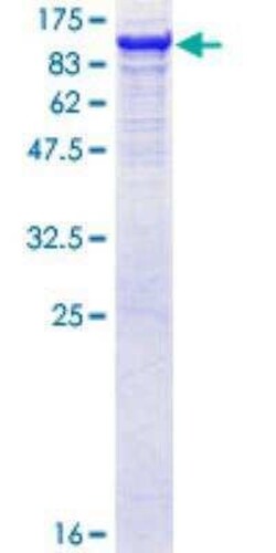 Novus Biologicals Recombinant Human GBE1 GST (N-Term) Protein 25 &mu;g | Buy Online | Novus Biologicals&trade; | Fisher Scientific